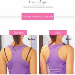 Merkloos BH Clip - Set Van 3 Stuks - Bra Buckles - Hot Koop - Fashion - Sluiting - Strap Clip - Onzichtbare Beha Gesp - Houders - Band - Clips -Badmode Verkoop 550x521 9